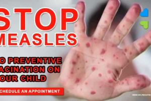 Stop Measles with North Florida Pediatrics PA Measles Preventive Vaccination 2025