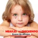 Chickenpox vs measles, what’s the difference?